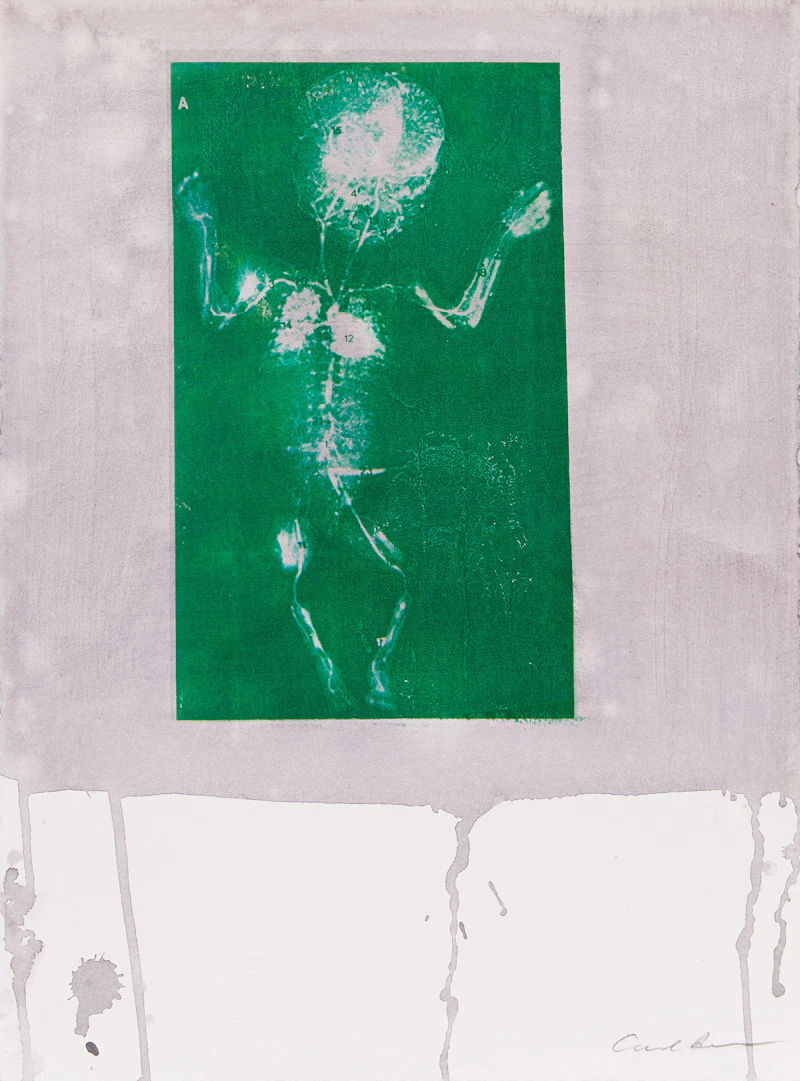 Ultrasound by Carl Beam