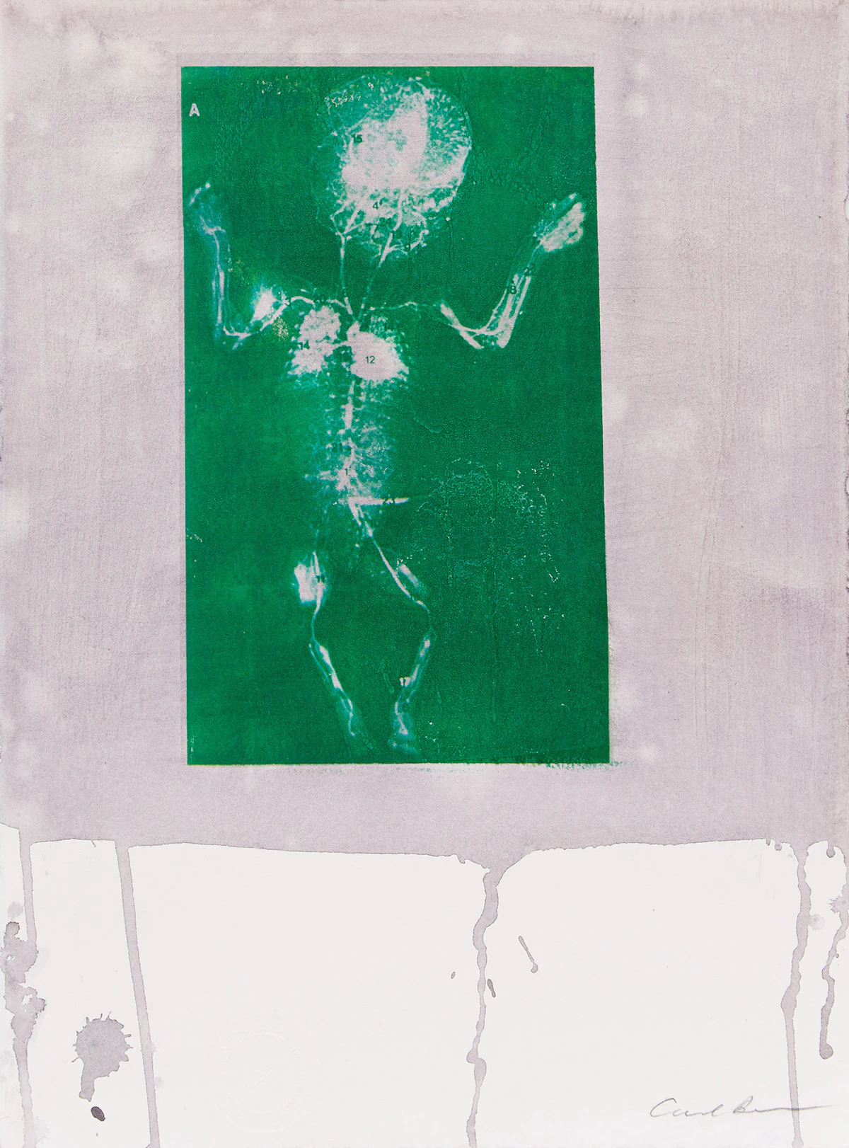 Carl Beam, Ultrasound, mixed media on paper